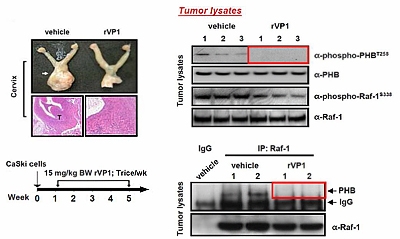 rVP1抑制小鼠原位子宮頸腫瘤生長