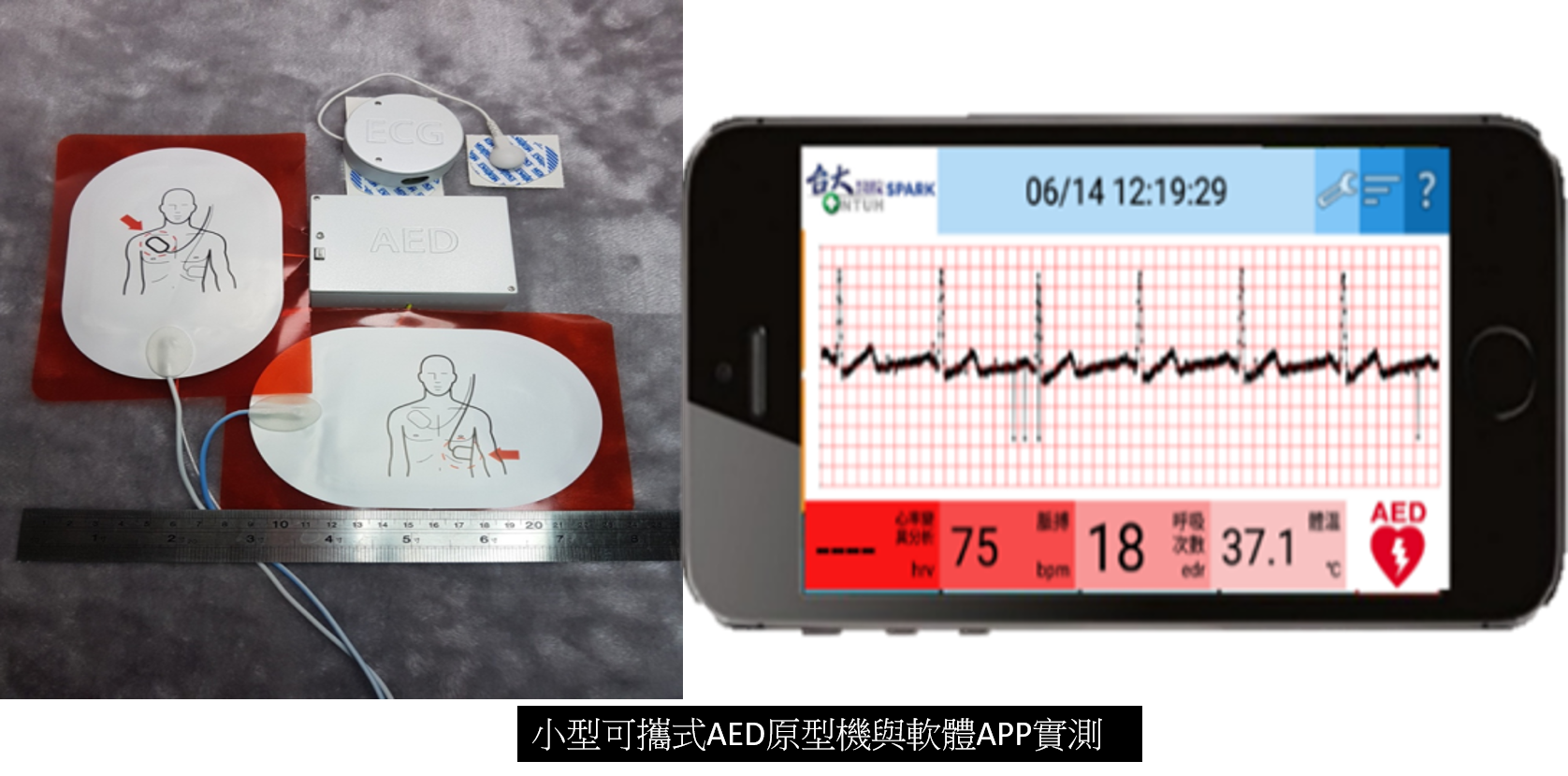 小型可攜式AED緊急救護與CPR輔助裝置系統
