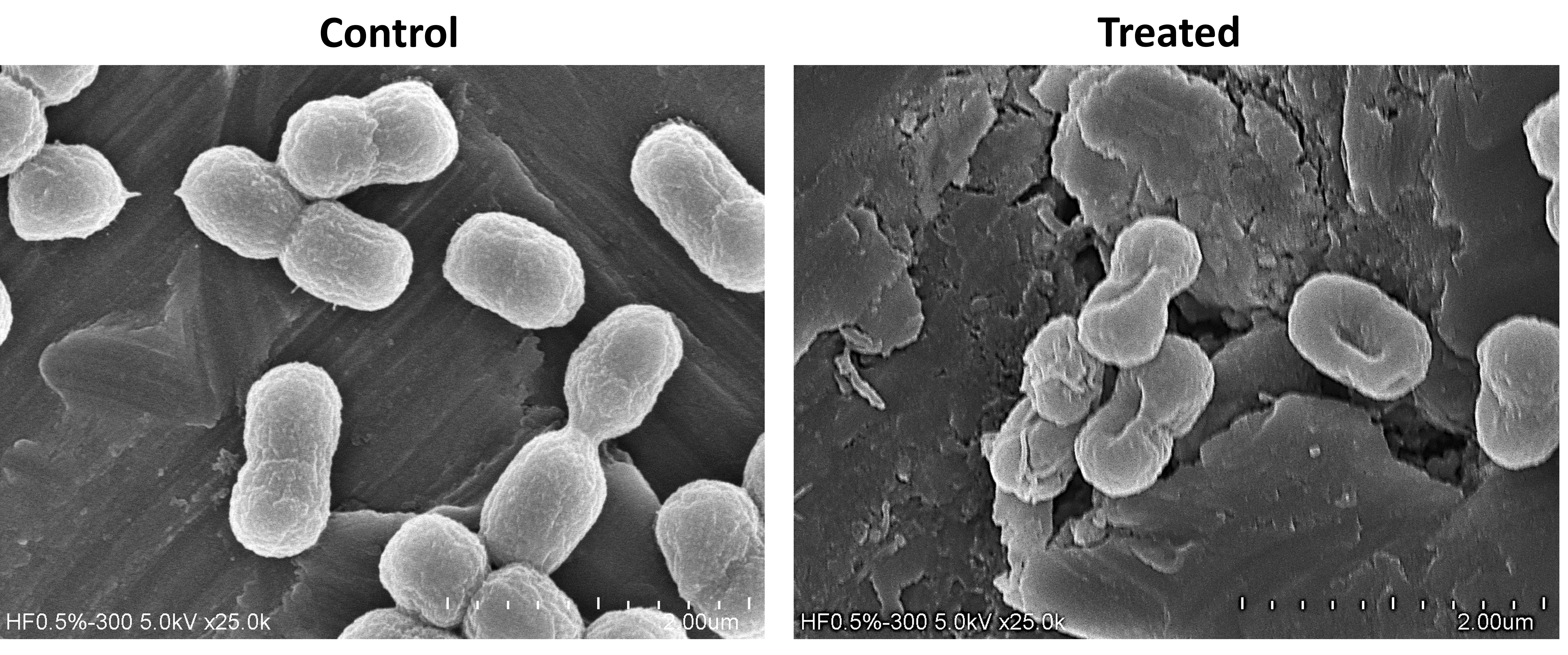 開發全新種類抗生素—有機碲化合物應用於細菌感染症治療
